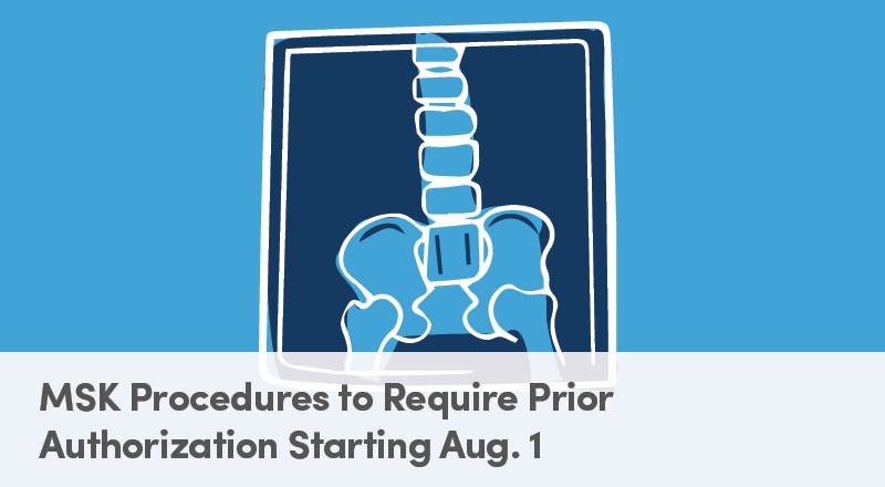 MSK Procedures to Require Prior Authorization Starting Aug. 1